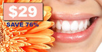 50%OFF  Teeth Whitening Kit Deals and Coupons